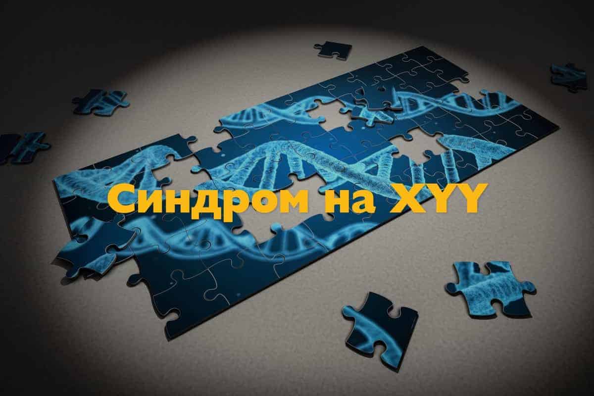 Синдром на XYY