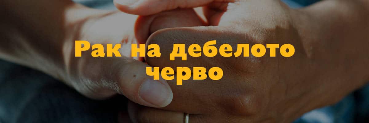 рак на дебелото черво рак на дебелото черво