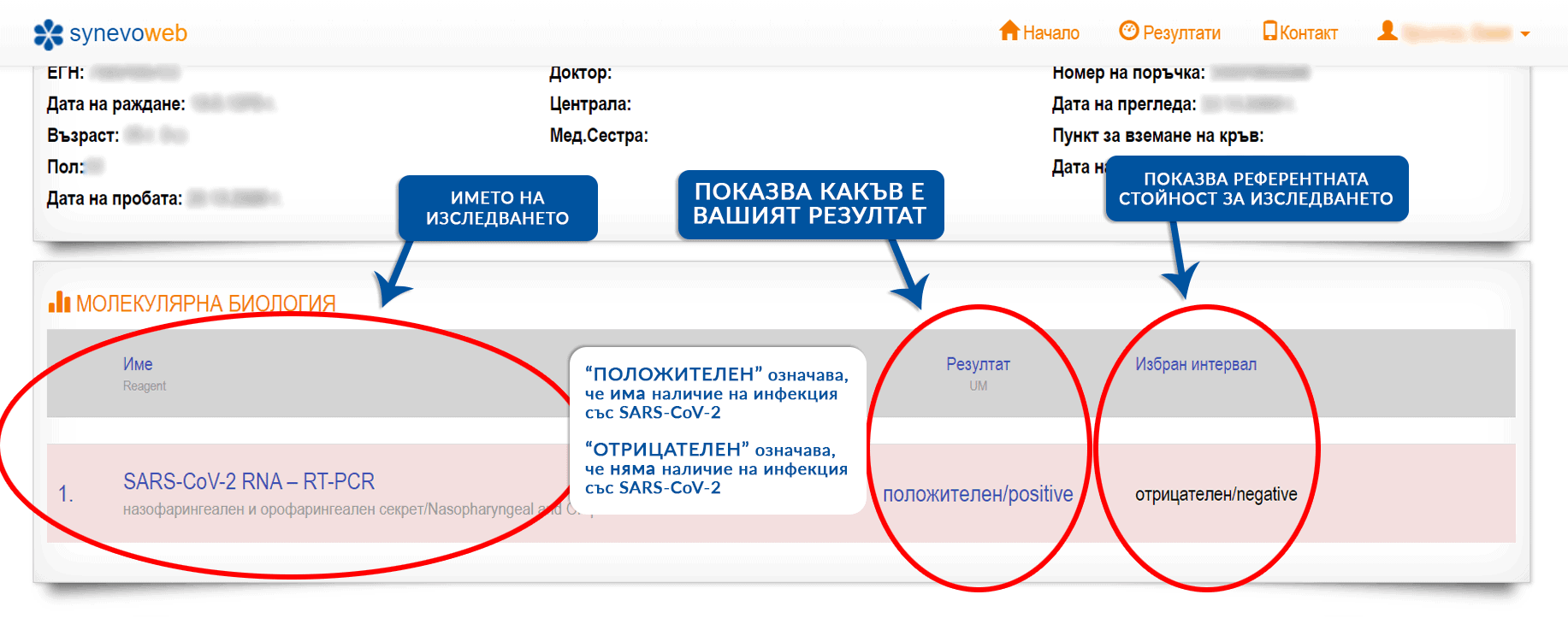 как да разчитаме резултати